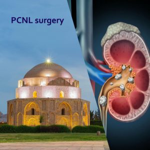 PCNL SURGERY