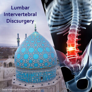 Lumbar disc surgery