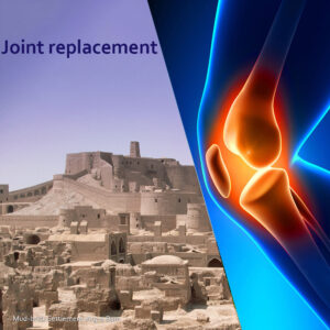 joint replacement